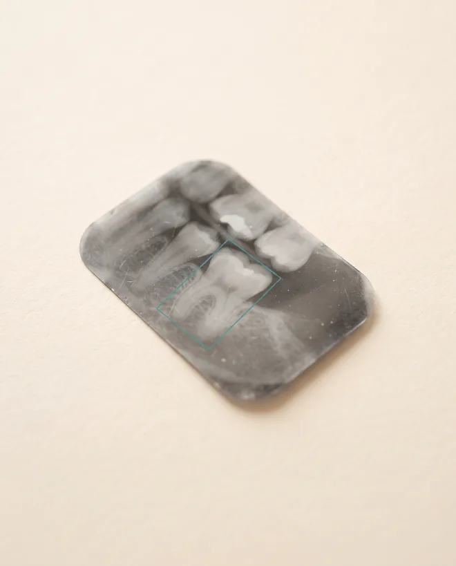 A single dental bitewing radiograph film resting on warm off-white paper