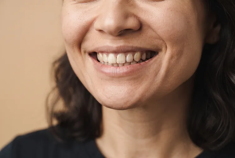 A natural adult smile with even