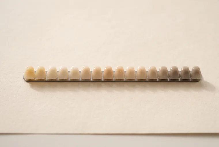 A row of small composite shade buttons in graduating tooth colours on warm off-white paper