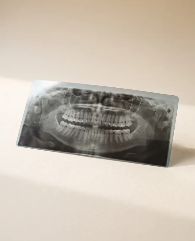 A panoramic dental radiograph film resting on warm off-white paper
