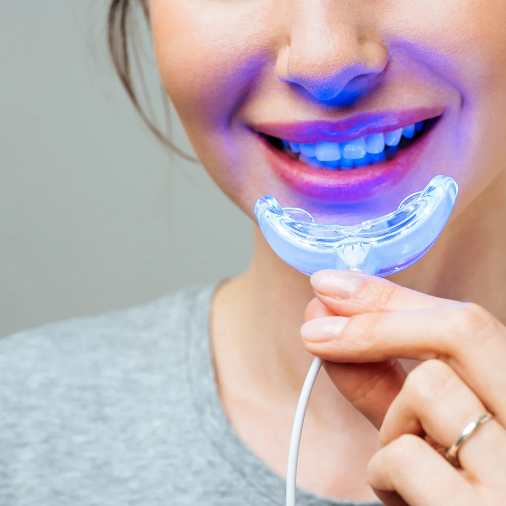 Patient using an LED whitening tray during an at-home teeth whitening treatment