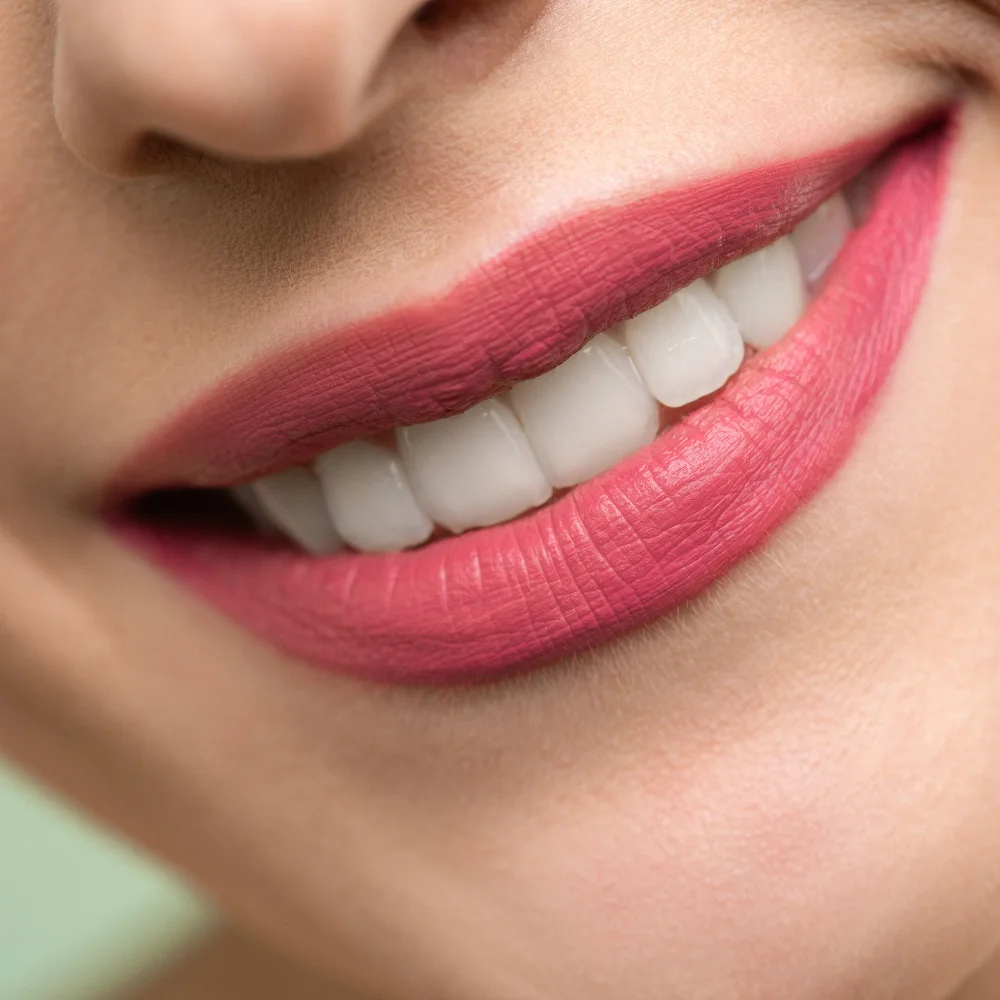 Close-up of smooth white teeth showing the results of cosmetic teeth whitening treatment