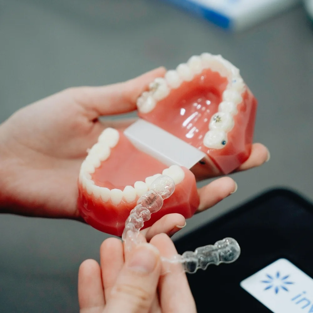 Dental professional demonstrating clear aligner trays with a dental model for orthodontic treatment planning