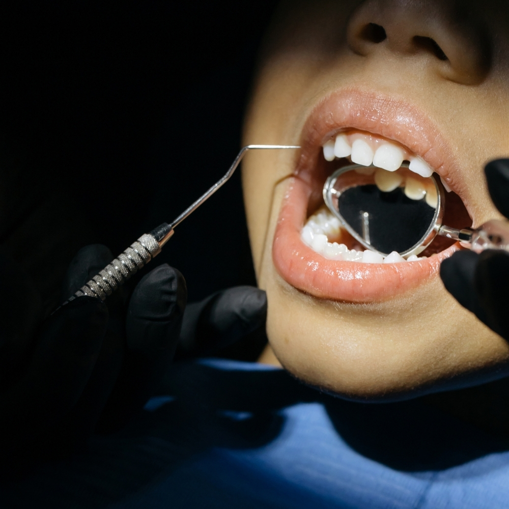 Dentist examining teeth during a cosmetic dental veneer consultation and smile evaluation