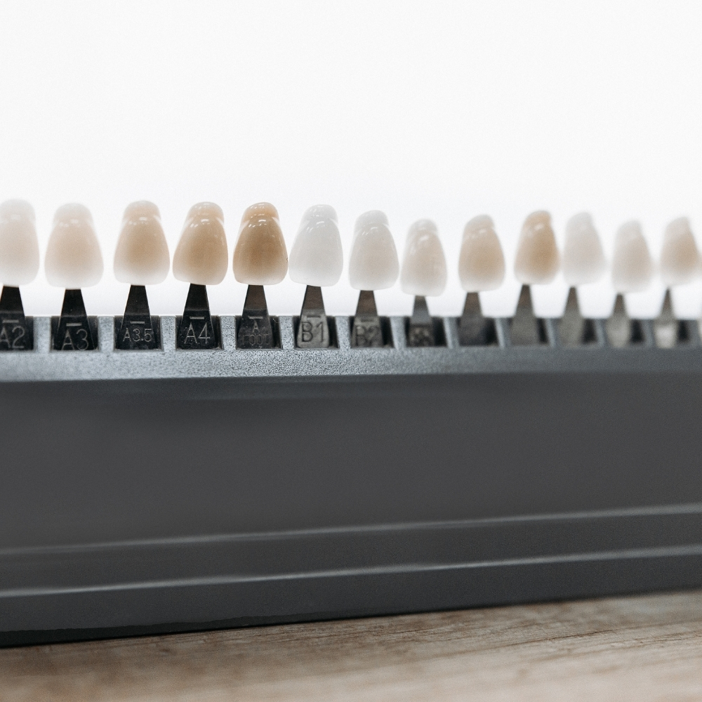 Different dental veneer shades used to match natural tooth color during cosmetic treatment