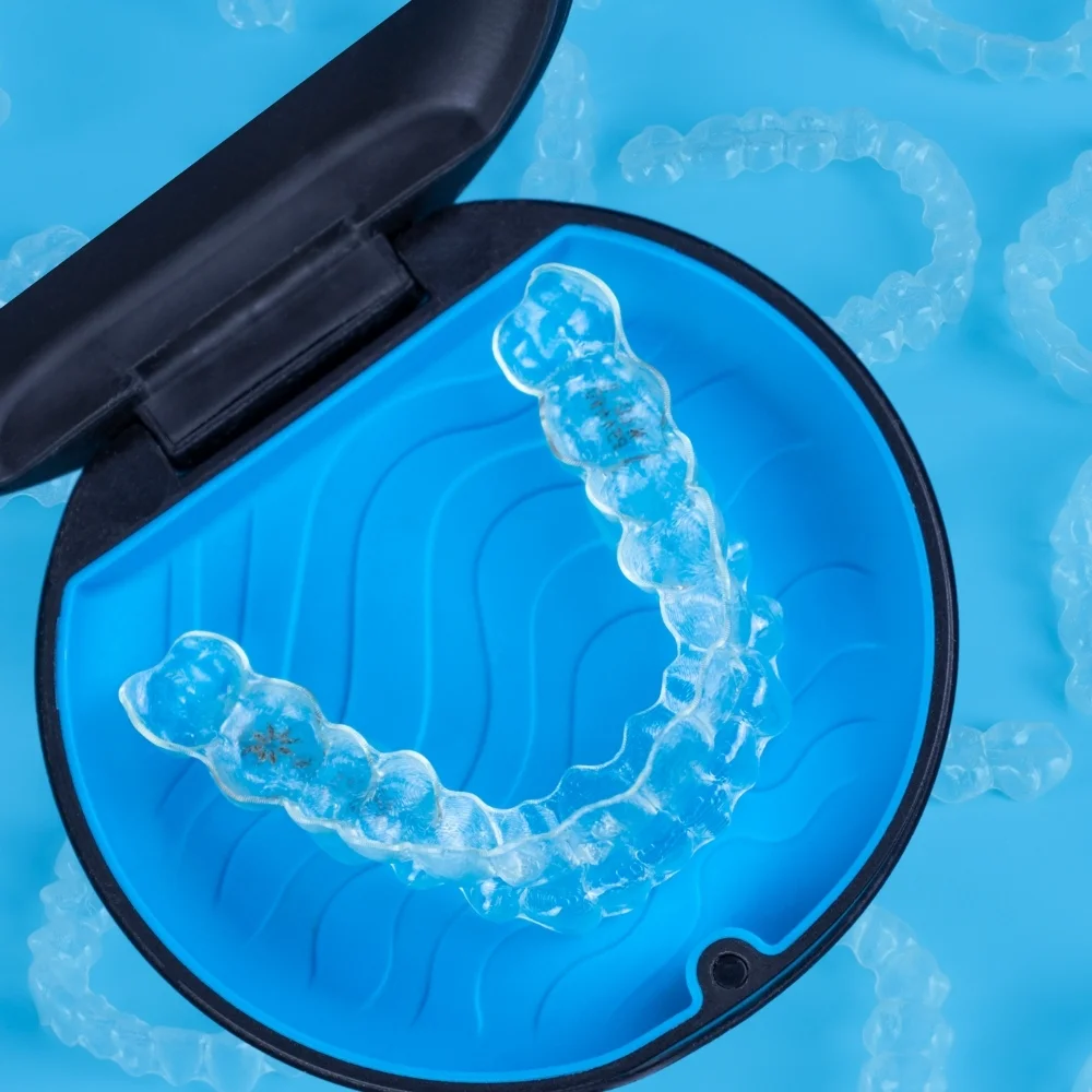 Clear aligner tray stored inside a blue protective case for safe and hygienic orthodontic care