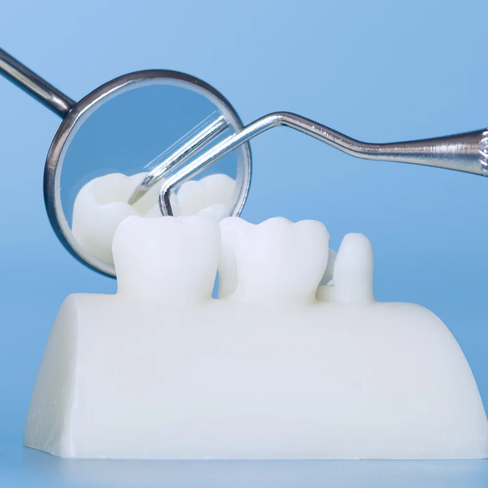Dental restoration model with crown preparation and dental tools used for restorative treatment