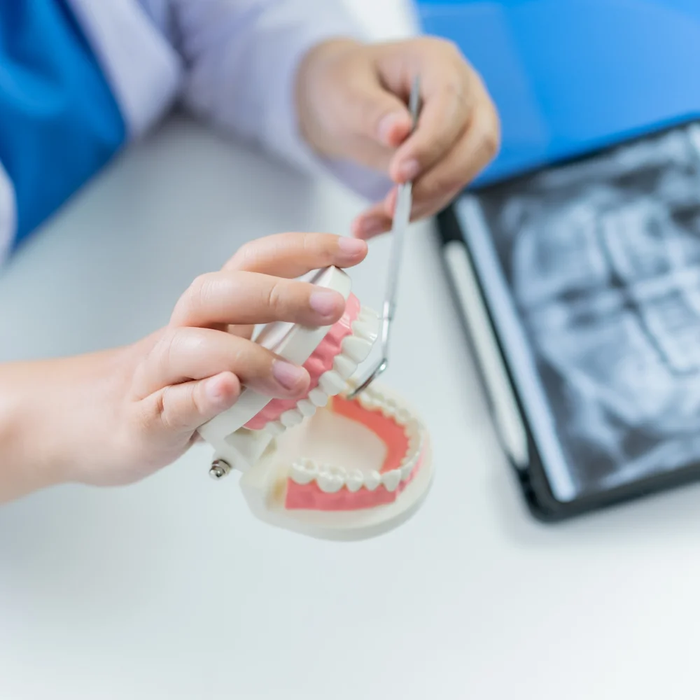 Dental professional using a tooth model to explain oral surgery and tooth extraction procedures