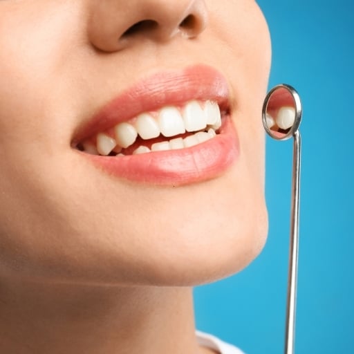 Close-up of healthy white teeth with a dental mirror during a cosmetic smile evaluation